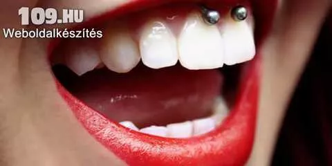 Apróhirdetés, Ínyfék, nyelvfék piercing (Smiley)